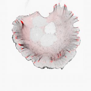 OVCAR-3 cell shaped as a rough semi-circle, with black actin fibres supporting red paxillin (focal adhesion) spikes around the inside of the circular edge