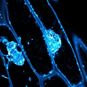 Large aggregations of endomembrane components and plant cell wall polysaccharides accumulate in mutants with defects in sidechain addition to xyloglucan polysaccharides. Hoffmann &amp; McFarlane demonstrated that these sidechains are required for efficient packaging and secretion of polysaccharides to the plant cell wall. Image is of 5-day-old etiolated hypocotyls of Arabidopsis thaliana mur3 mutants; membrane-associated dye FM4-64 (labelled in cyan) is internalized by endocytosis and also labels the large (>10 um) aggregations inside these mutant cells. Image credit: Natalie Hoffmann.