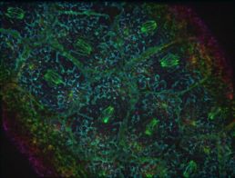 Arched green strands denote microtubules associated with dividing nuclei in an image of multiple nuclei at the surface of the Drosophila embryo. Poorly defined green lines around individual nuclei form a cobblestone pattern. Infolding membranes forms a brindled pattern in cyan